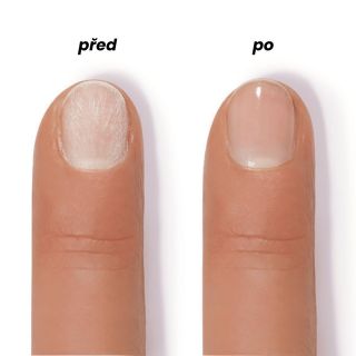 💅✨ SOS pro tvé nehty! ✨💅 Slabé, lámavé nebo roztřepené nehty? Řekni jim stop! 🚫 🌟 Co umí? ✔️ Biotin – pevnější a odolnější...
